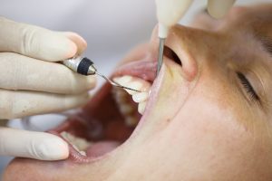 periodontal health